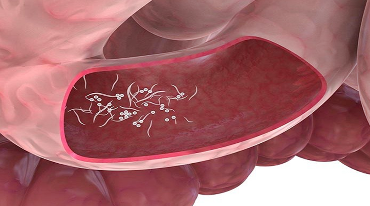 كيف تعرف أن جسمك ملئ بالطفيليات والديدان: 6 علامات خفية تشير لذلك